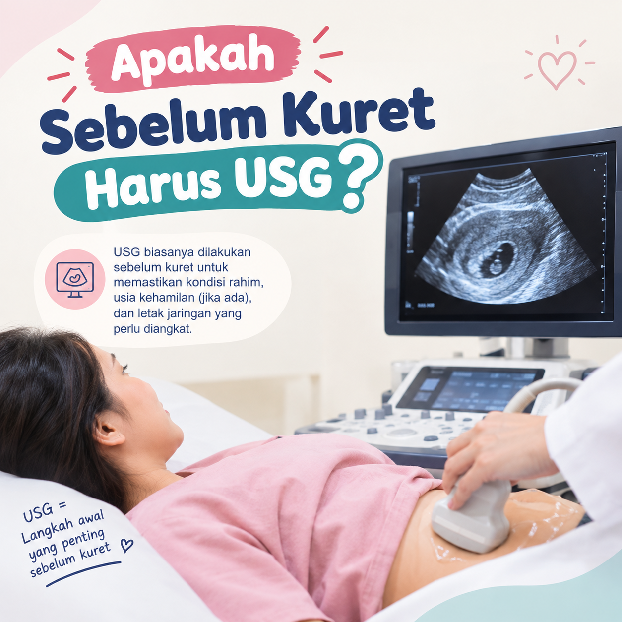 Apakah Sebelum Kuret Harus USG?